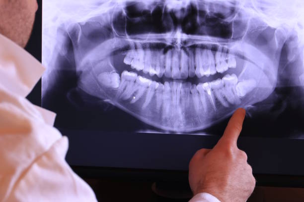 Best Dental Abscess Treatment in Sandpoint, ID