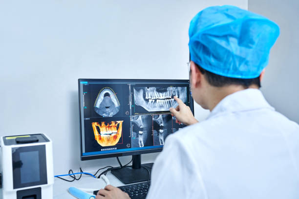 Best Knocked-Out Tooth (Avulsed Tooth) Treatment in Sandpoint, ID